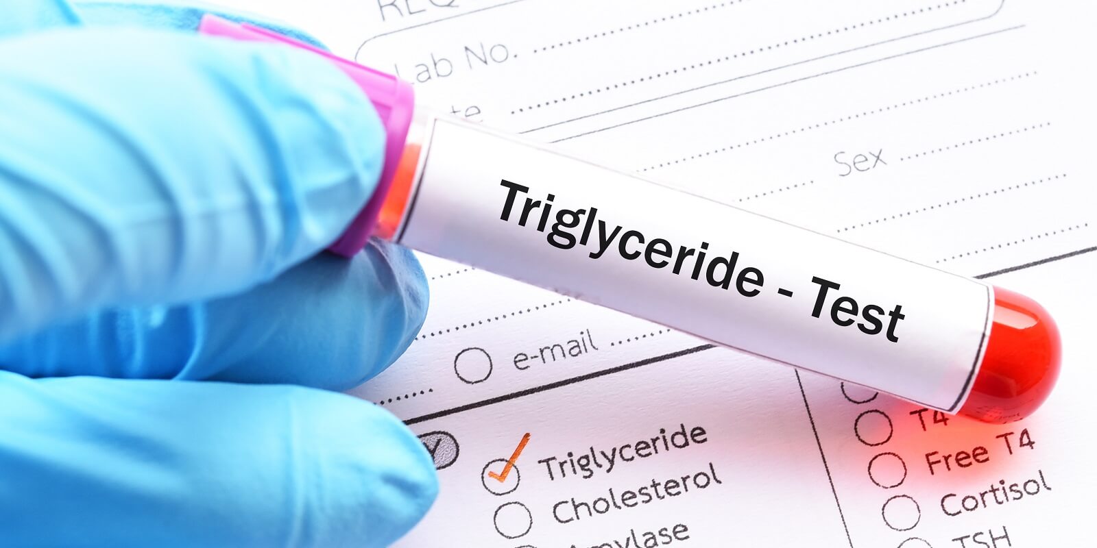 Why You Care About Triglycerides and Blood Glucose.